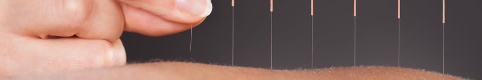 Why use Mayo Acupuncture